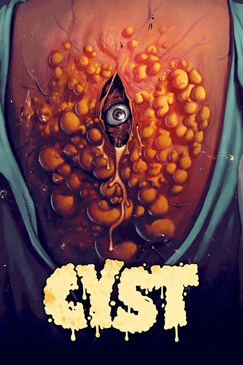 Cyst full movie