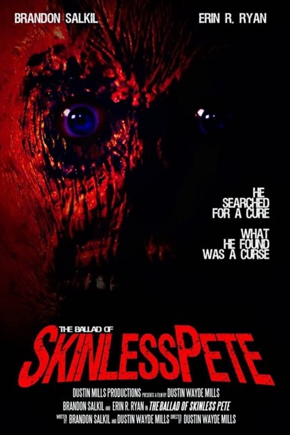 The Ballad of Skinless Pete full movie